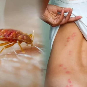 مكافحة حشرات البق